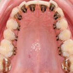 التقويم اللساني