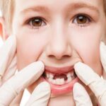اصابات اسنان الأطفال