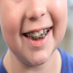 التقويم الوقائي عند الأطفال