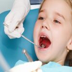 حشوات اسنان الأطفال