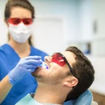 تبييض الأسنان بالليزر: أسرار الإبتسامة الفائقة 2024