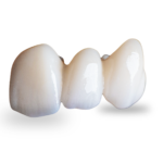 تجربتي مع تركيبات الزيركون