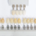 درجات ألوان اسنان الزيركون تناسب جميع الأذواق: بالصور