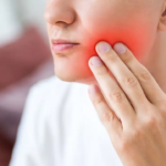 صور التهاب اللثة