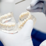 تركيب الزيركون للأسنان